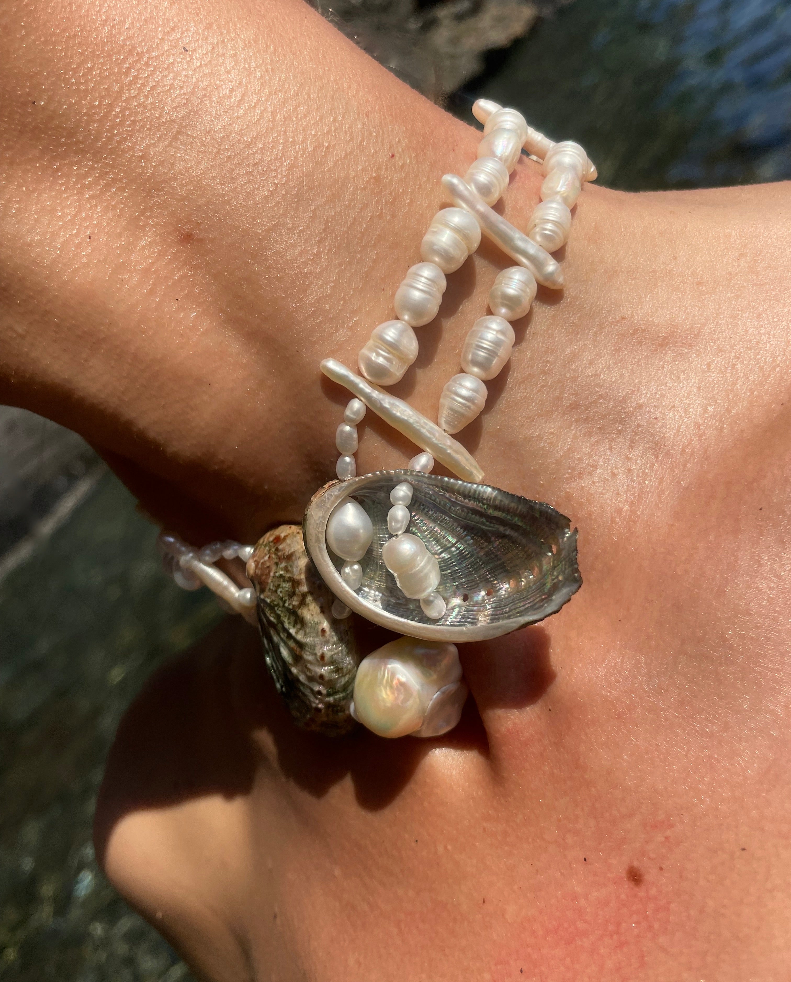ANNA CHOKER